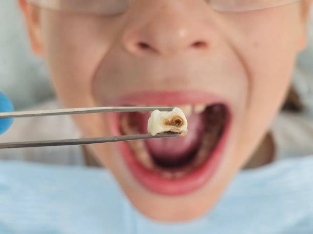 Best Tooth Pain Emergency Relief  in Todd Creek, CO